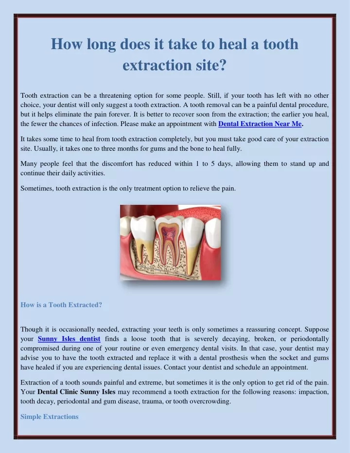 ppt-how-long-does-it-take-to-heal-a-tooth-extraction-site-powerpoint