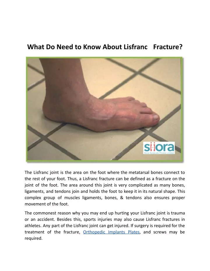 ppt-what-do-need-to-know-about-lisfranc-fracture-docx-1-powerpoint