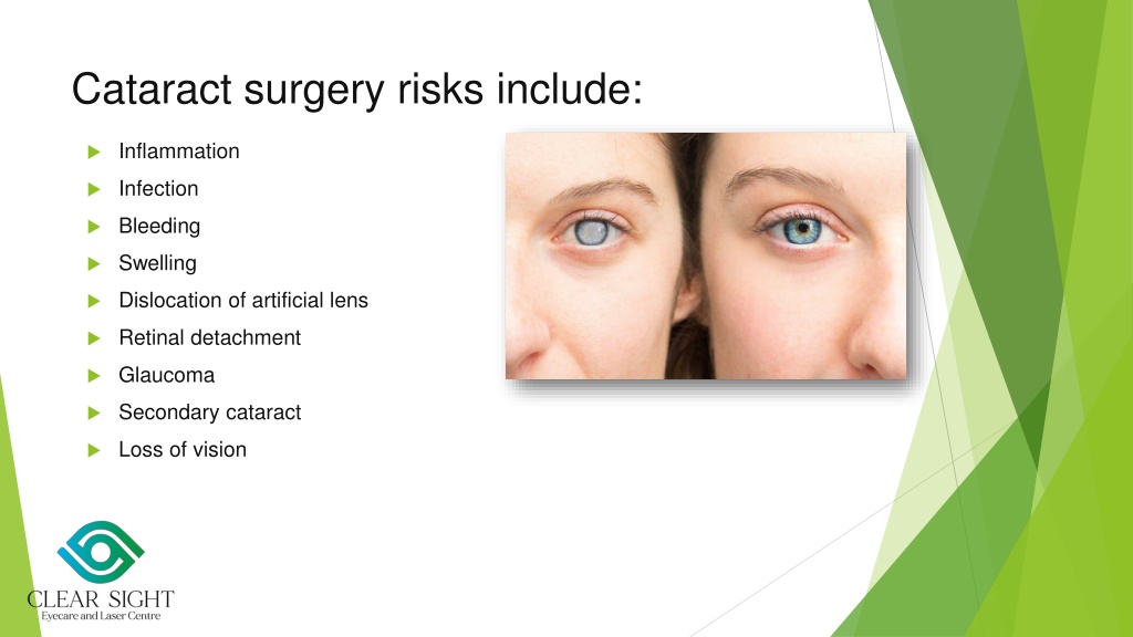 PPT - Cataract Surgery_Dr. Sonia Maheshwari PowerPoint Presentation ...