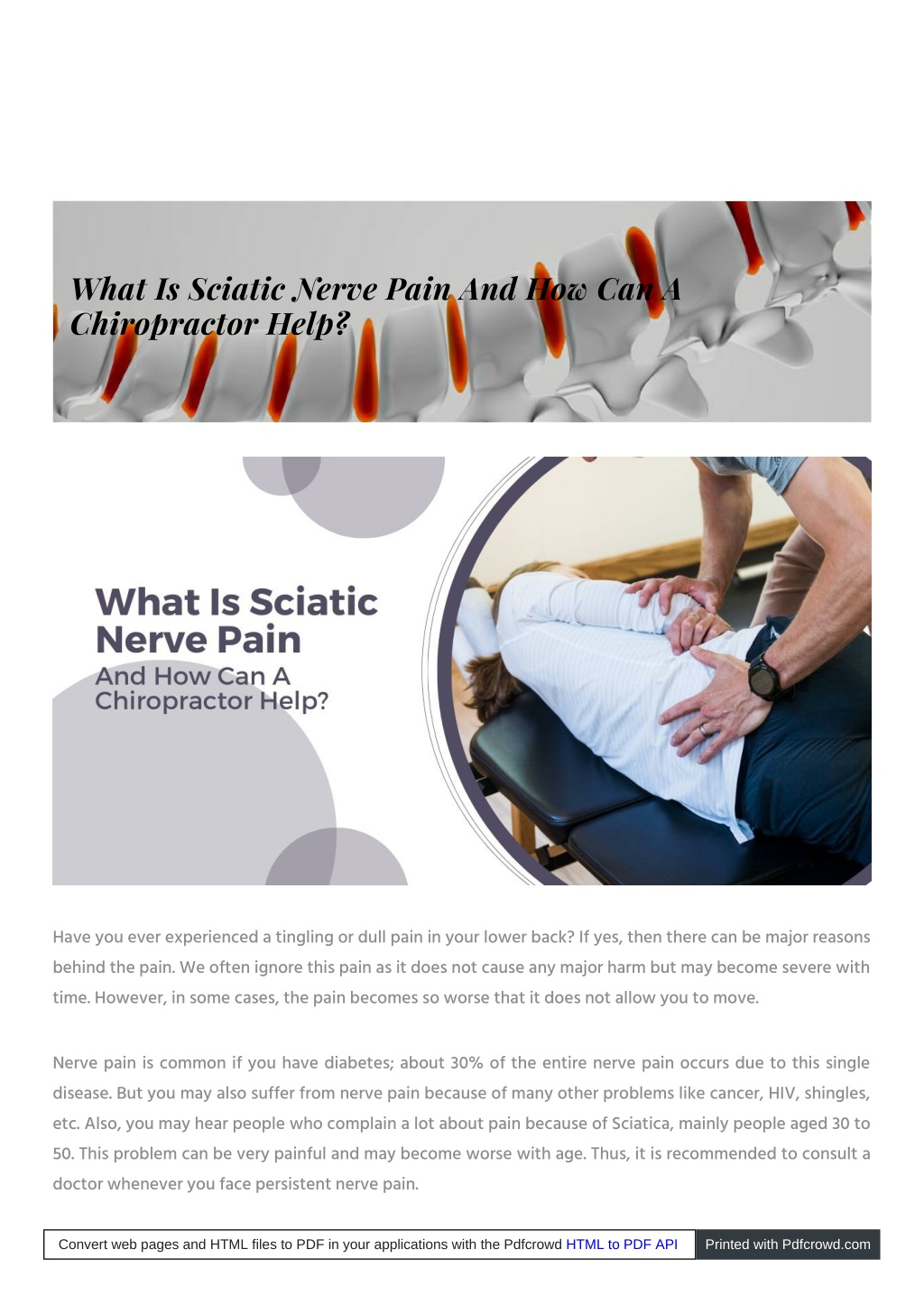 PPT - What Is Sciatic Nerve Pain And How Can A Chiropractor Help ...