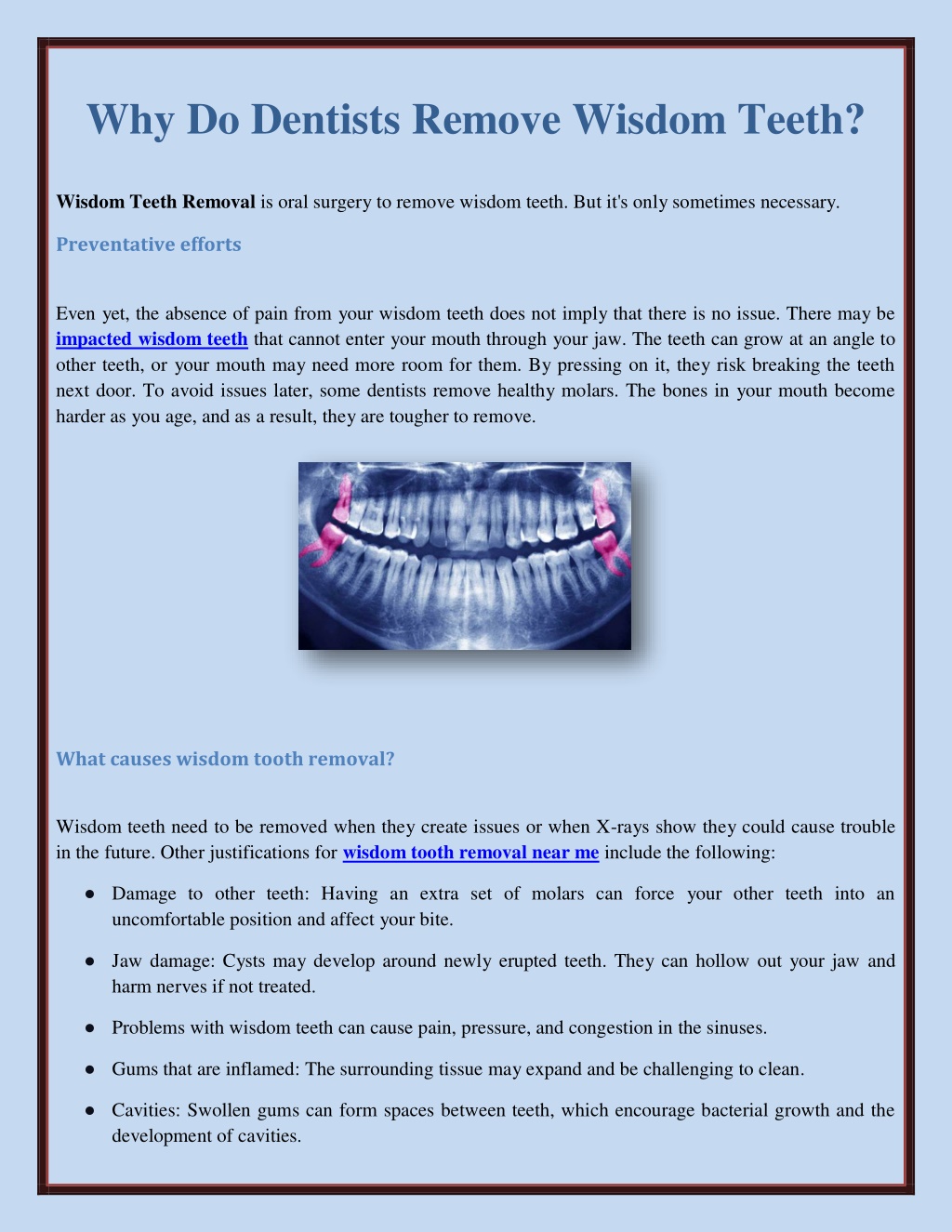 PPT - Why Do Dentists Remove Wisdom Teeth? PowerPoint Presentation ...