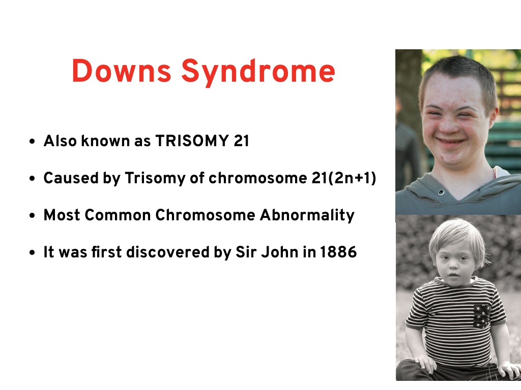 PPT - common chromosomal Disorders PowerPoint Presentation, free ...