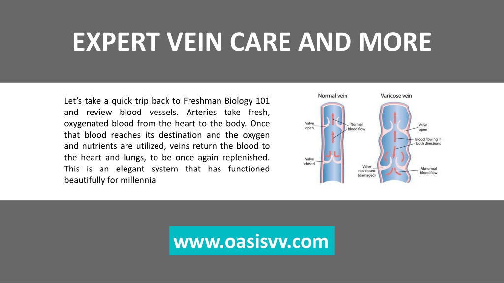 Ppt Expert Vein Care At Oasis Vein And Vitality Powerpoint