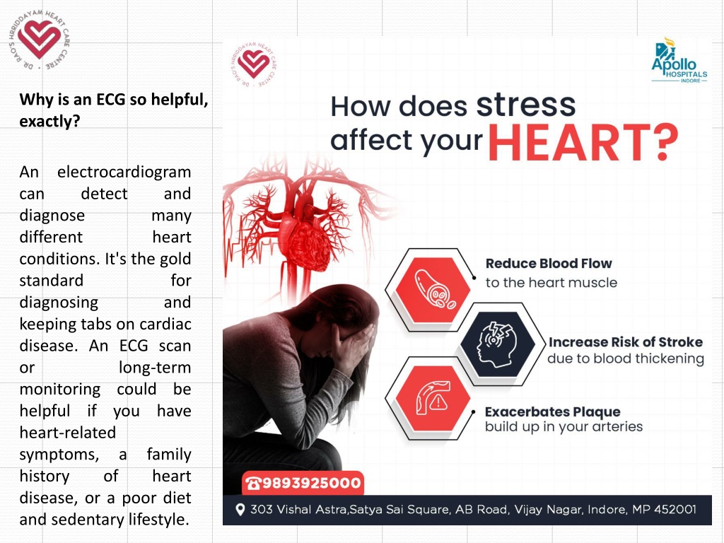 Why Is Ecg Monitoring Important