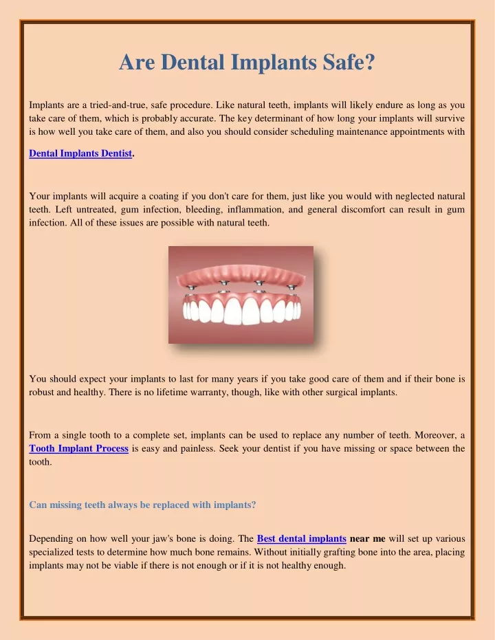 Ppt Are Dental Implants Safe Powerpoint Presentation Free Download Id