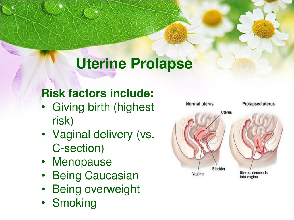 PPT Best Uterus Prolapse treatment PowerPoint Presentation, free