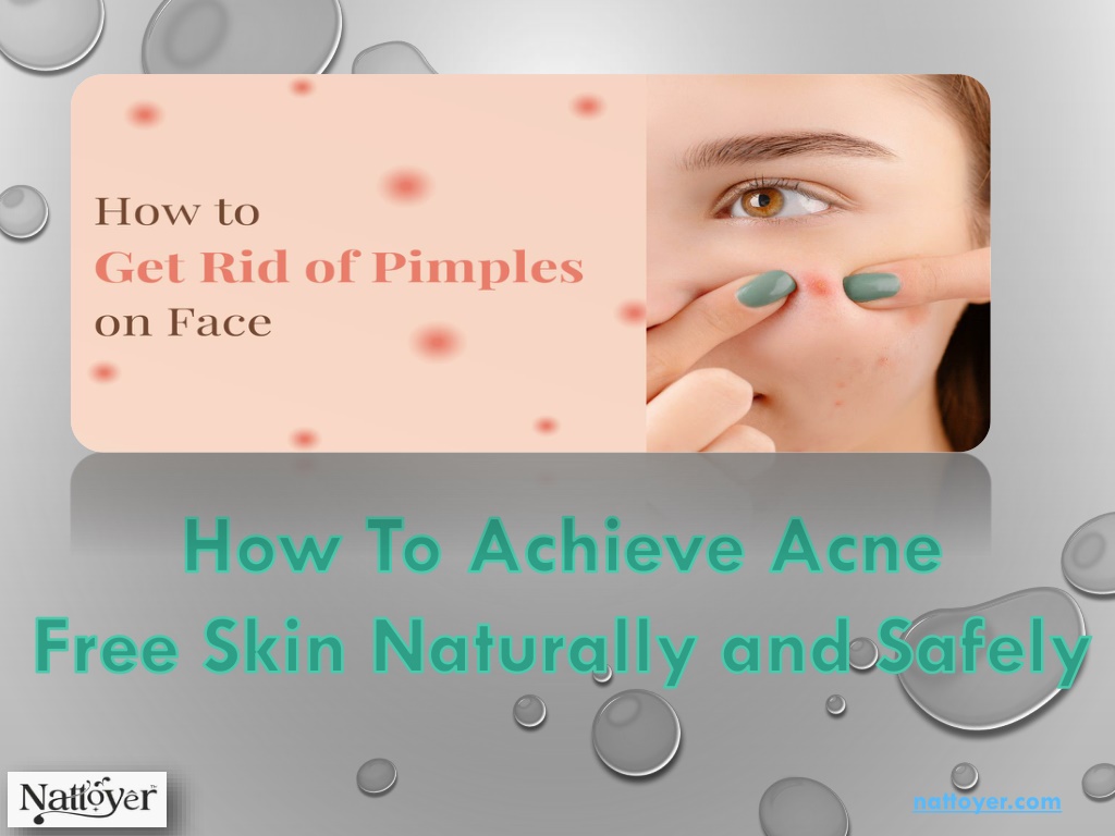 PPT - How To Achieve Acne free skin Naturally PowerPoint Presentation ...