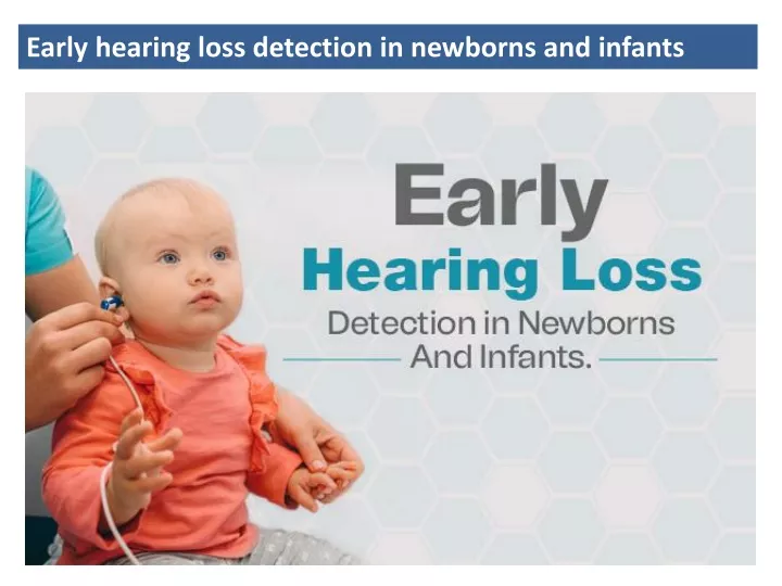 PPT - Early Hearing Loss Detection In Newborns And Infants PowerPoint ...