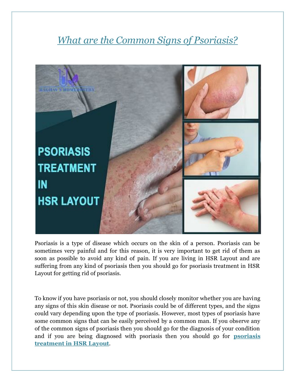 Ppt What Are The Common Signs Of Psoriasis Powerpoint Presentation Free Download Id11846082 