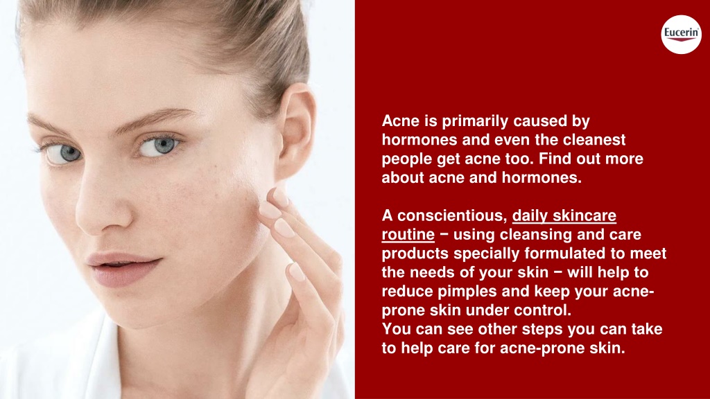 Ppt An Ideal Skincare Routine And Products For Acne Prone Skin