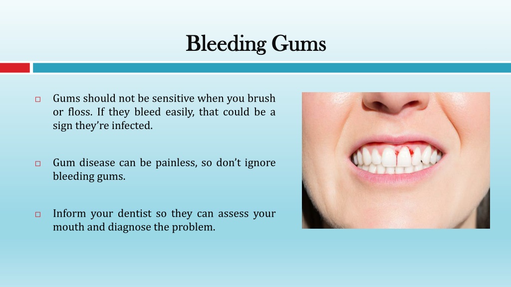 PPT - Signs You May Have a Dental Problem PowerPoint Presentation, free ...