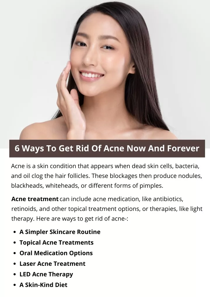 Ppt 6 Ways To Get Rid Of Acne Now And Forever Powerpoint Presentation Id11864396 