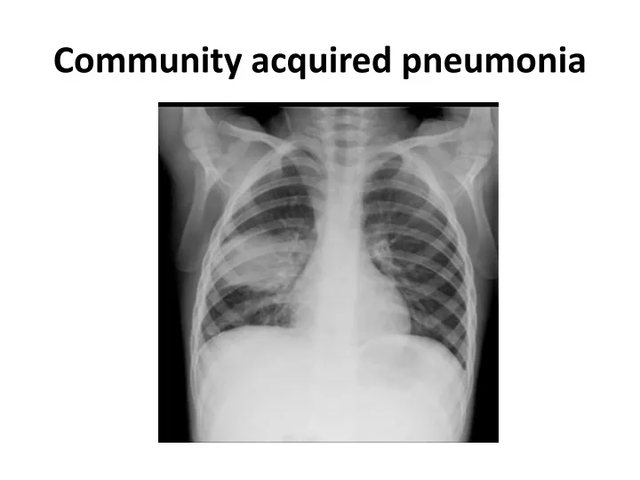 PPT - Community acquired pneumonia and Bronchiolitis reports by Dr ...