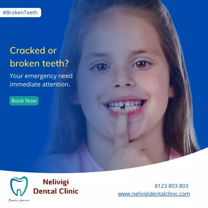 PPT - Cracked or broken teeth |Dental Clinic in Bellandur | Nelivigi ...