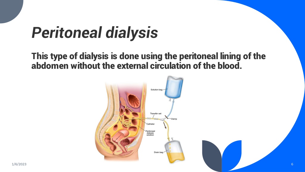 PPT - Dialysis & Care PowerPoint Presentation, free download - ID:11874848