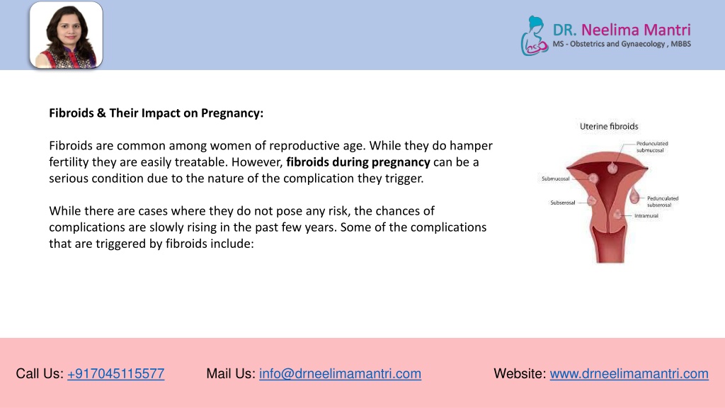 Ppt Fibroids In Pregnancy What You Should Know Dr Neelima Mantri Powerpoint Presentation