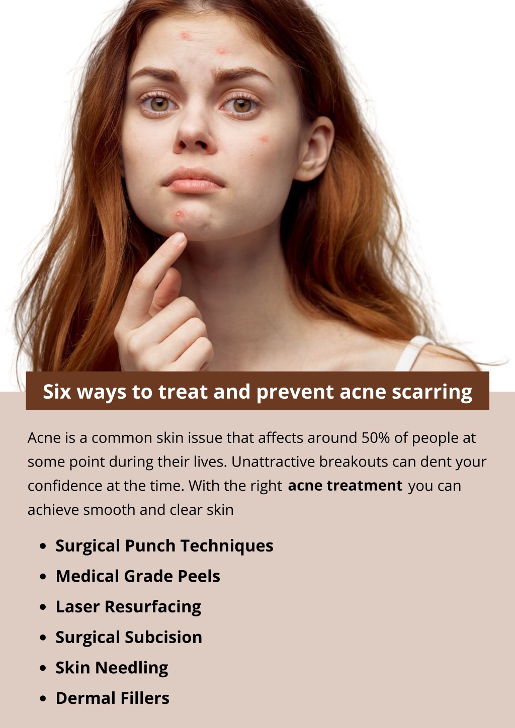 PPT - Six ways to treat and prevent acne scarring PowerPoint ...