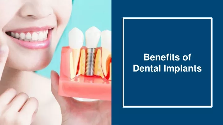 Ppt Benefits Of Dental Implants Nuface Dental Implant Powerpoint Presentation Id11889756 2701