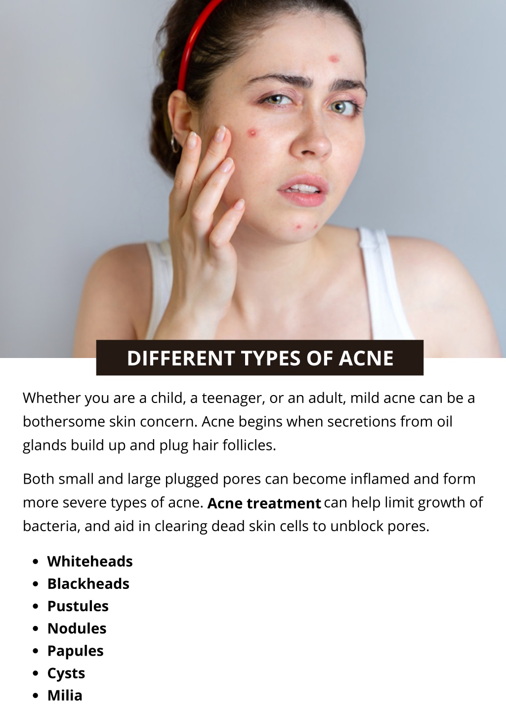 Ppt - 7 Different Types Of Acne Powerpoint Presentation, Free Download 