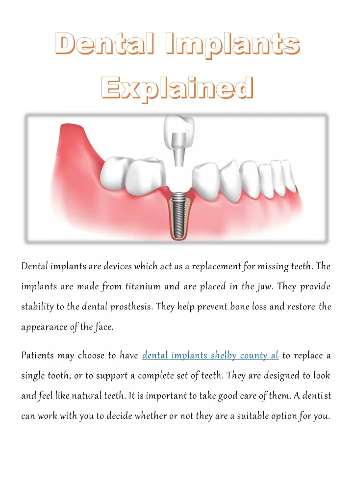 Ppt - Dental Implants Explained Powerpoint Presentation, Free Download 