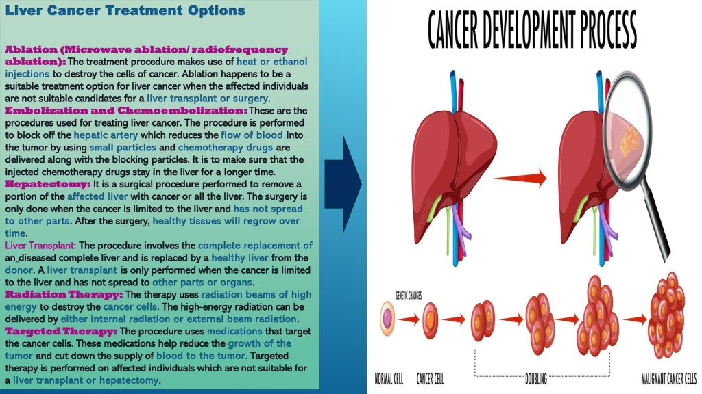 PPT - Liver Cancer: Types Of Liver Cancer And Treatment Options ...