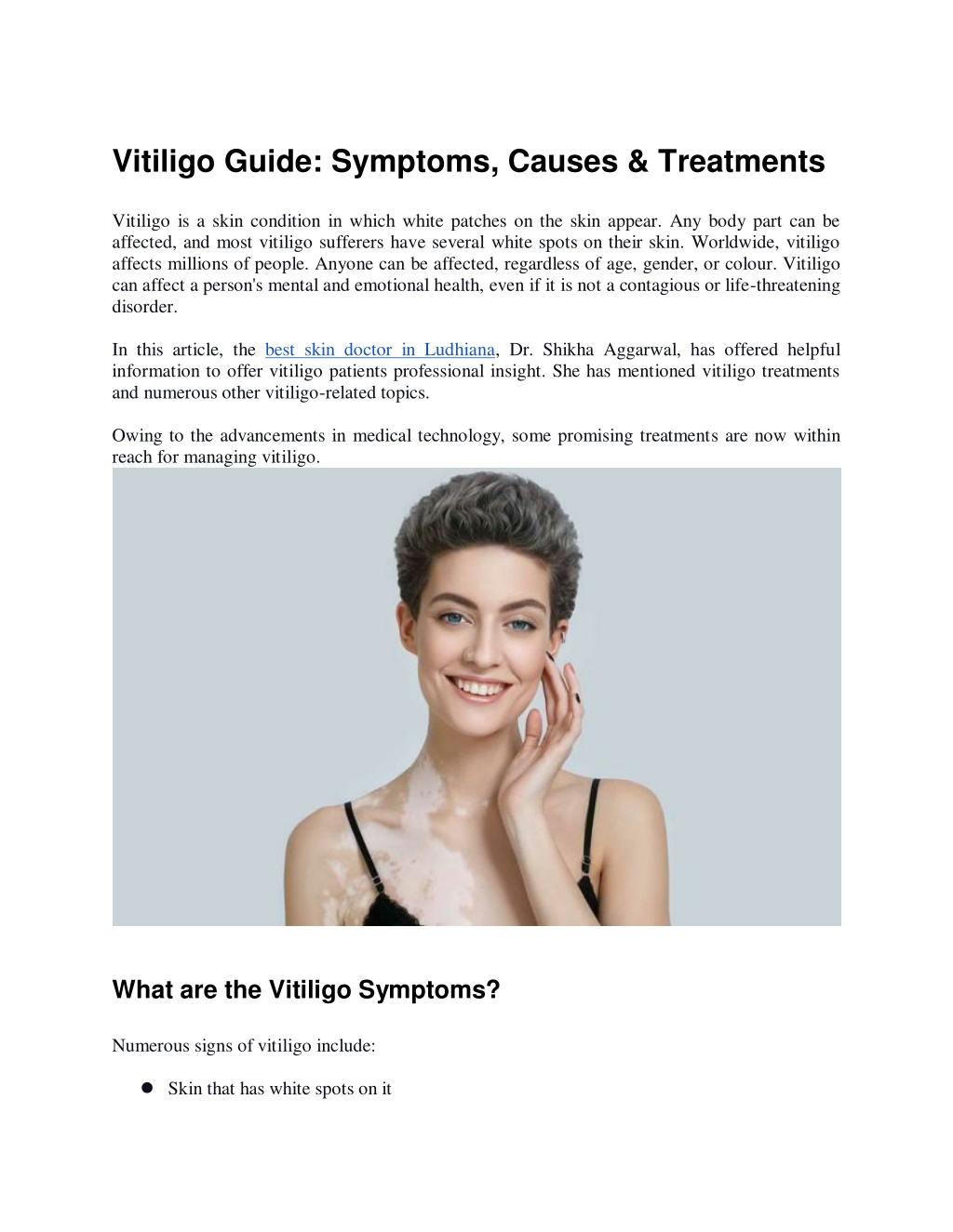 Ppt Vitiligo Guide Symptoms Causes And Treatments Powerpoint Presentation Id11913743 1530