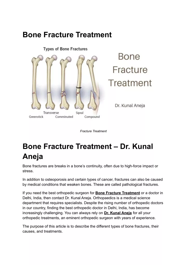 Ppt Bone Fracture Treatment Dr Kunal Aneja Powerpoint Presentation Id