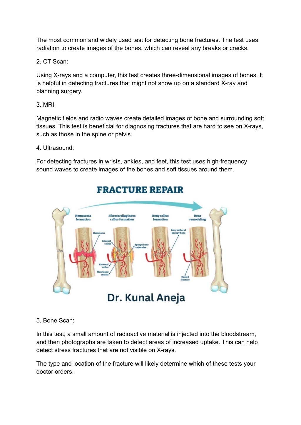 Ppt Bone Fracture Treatment Dr Kunal Aneja Powerpoint Presentation