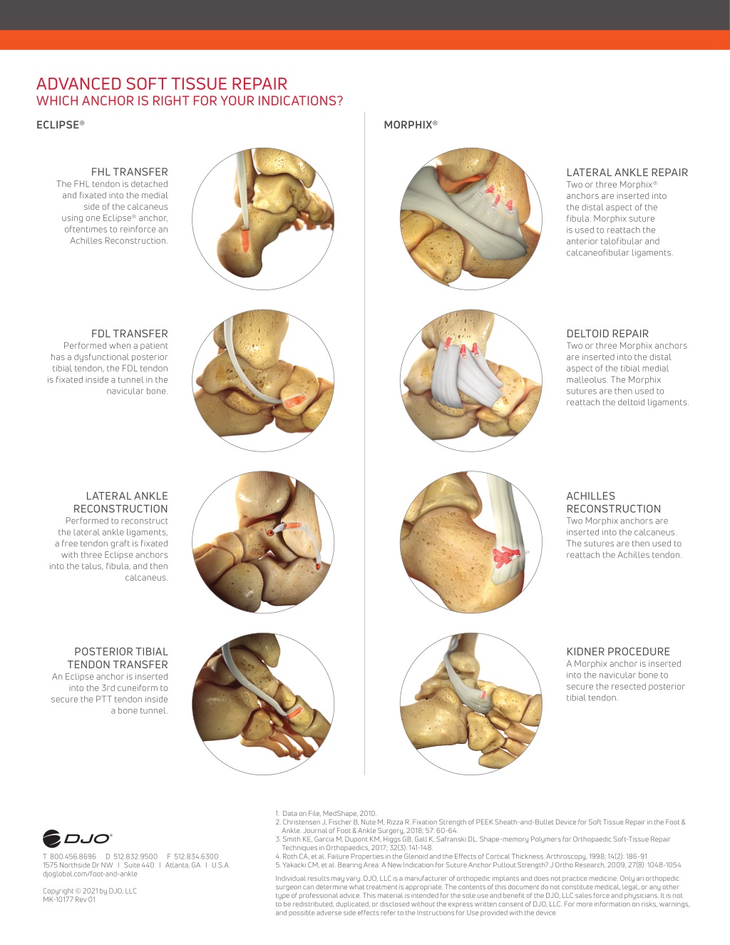 PPT - Eclipse® Soft Tissue Anchor - Enovis Eclipse® PowerPoint ...