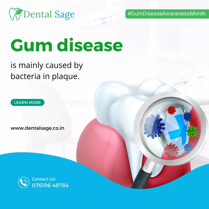 PPT Gum Disease Best Dental Clinic in Yelahanka, Bangalore Dental