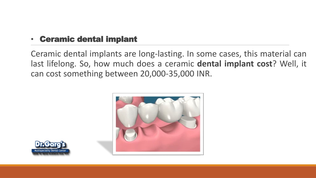 PPT How To Get The Perfect Dental Implant In Delhi? PowerPoint