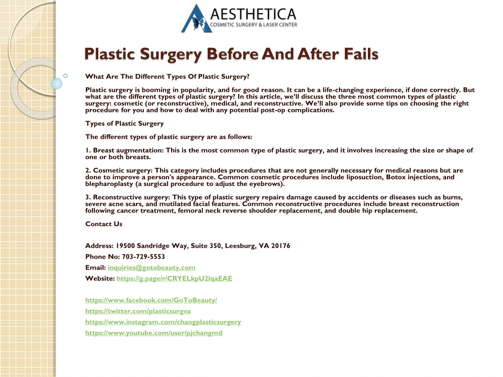 Ppt - Plastic Surgery Before And After Fails Powerpoint Presentation 