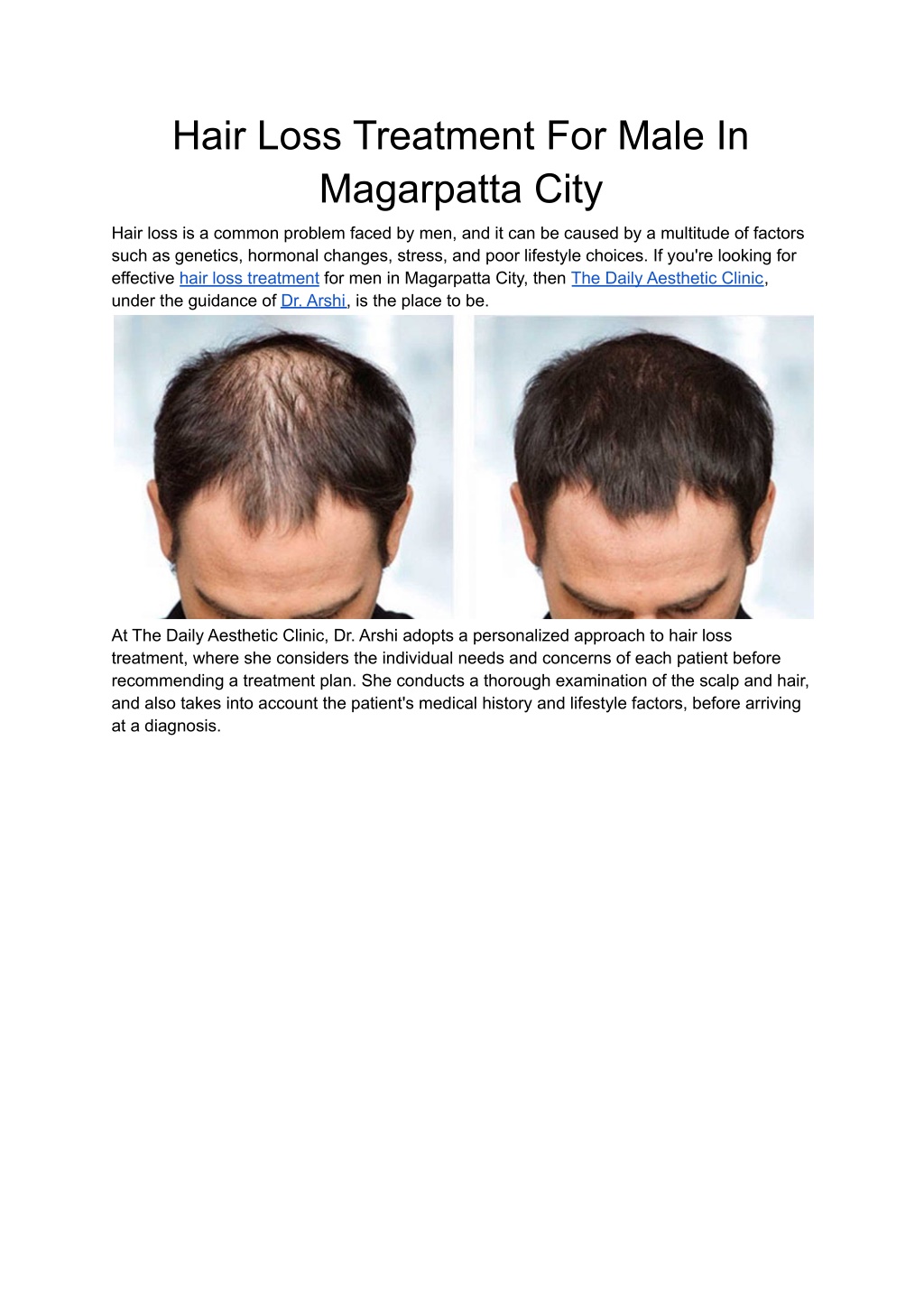 Ppt Hair Loss Treatment For Male In Magarpatta City Powerpoint Presentation Id 12007817