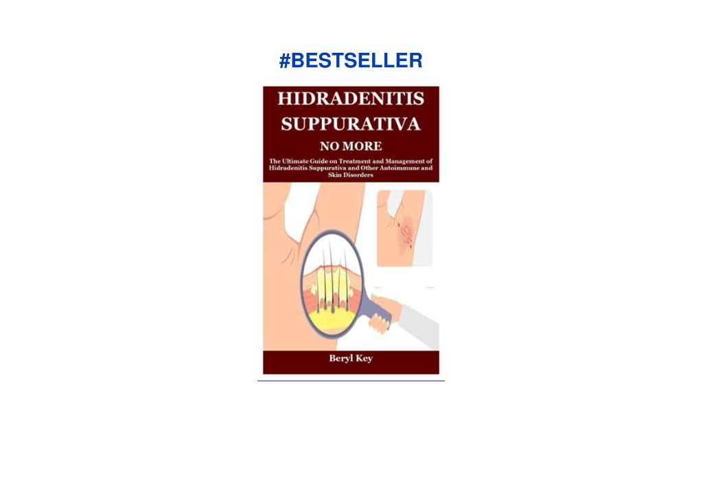 PPT - (PDF) HIDRADENITIS SUPPURATIVA NO MORE: The Ultimate Guide On ...