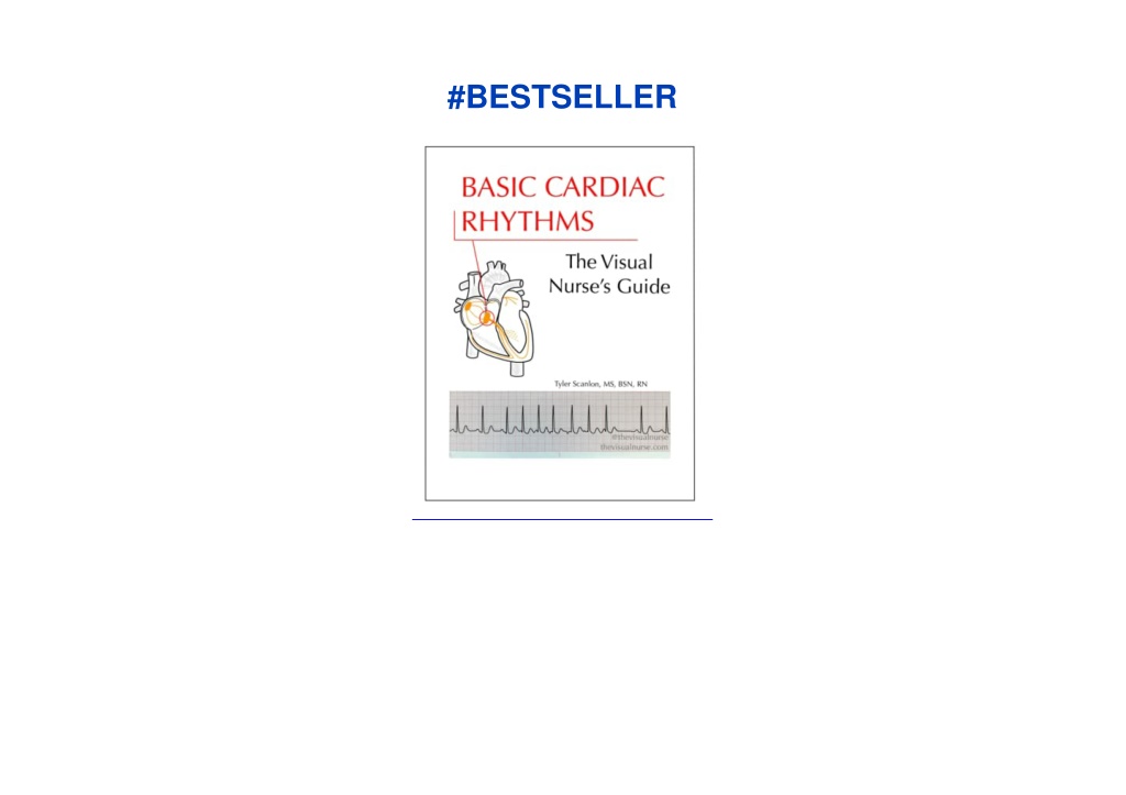 Ppt pdf basic cardiac rhythms the visual nurse s guide android