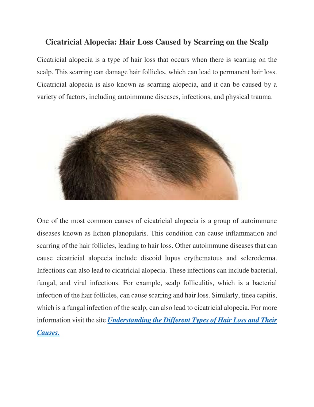 PPT - Cicatricial Alopecia PowerPoint Presentation, free download - ID ...