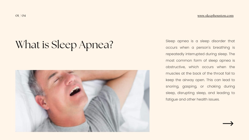 Ppt What Is Sleep Apnea Powerpoint Presentation Free Download Id