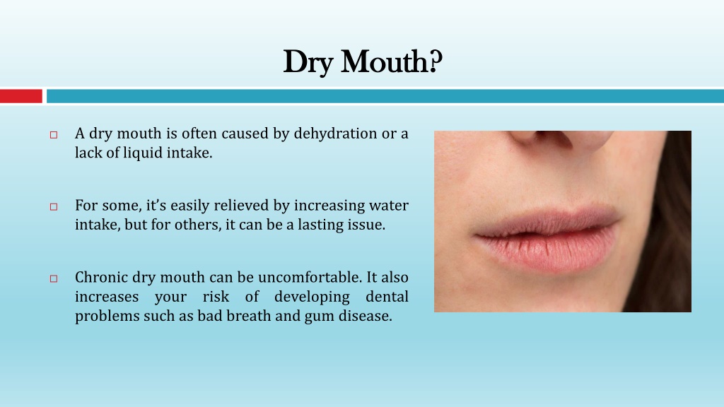 PPT - Important Habits to Effectively Soothe Dry Mouth PowerPoint ...