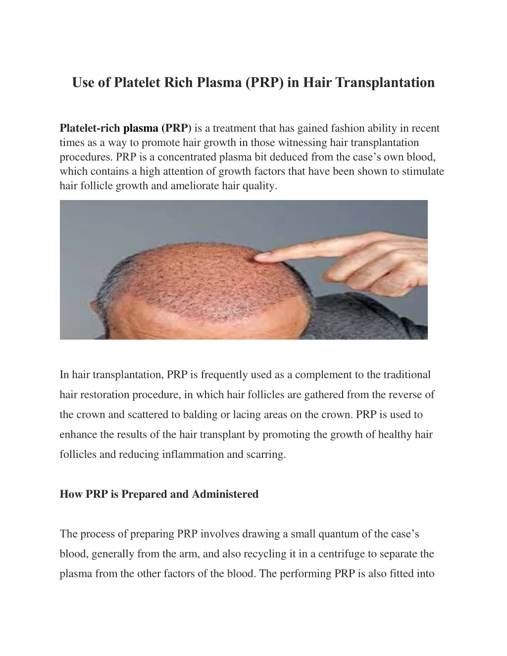 PPT - Use Of Platelet Rich Plasma PowerPoint Presentation, Free ...