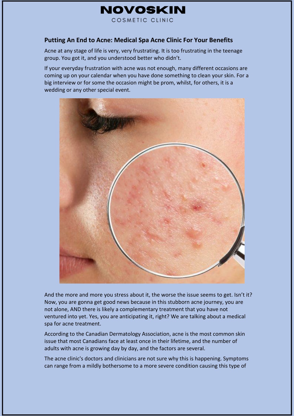 Ppt Putting An End To Acne Medical Spa Acne Clinic For Your Benefits Powerpoint Presentation 