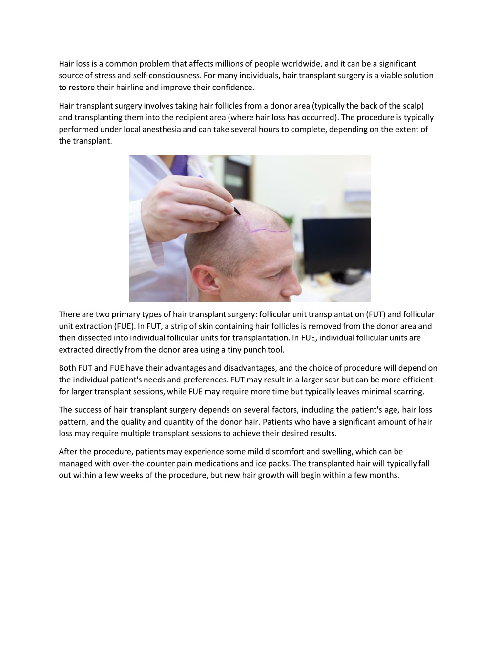 PPT - Hair Transplant PowerPoint Presentation, free download - ID:12028826