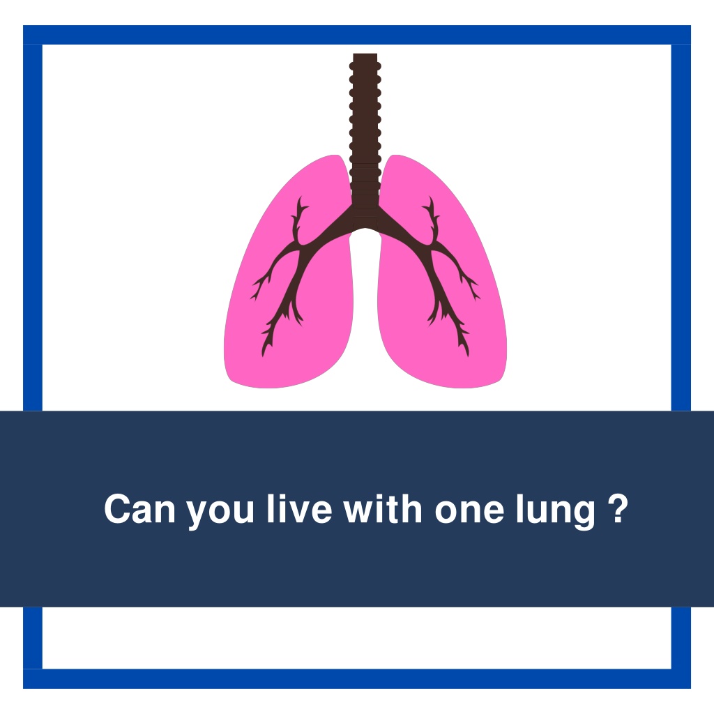 PPT - Can you live with one lung Best Lung Cancer Doctor in Bangalore ...