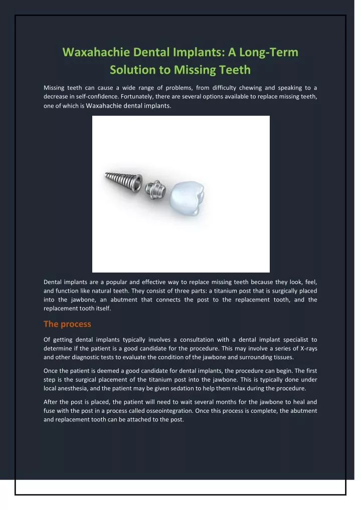 PPT Waxahachie Dental Implants A Long Term Solution to Missing Teeth