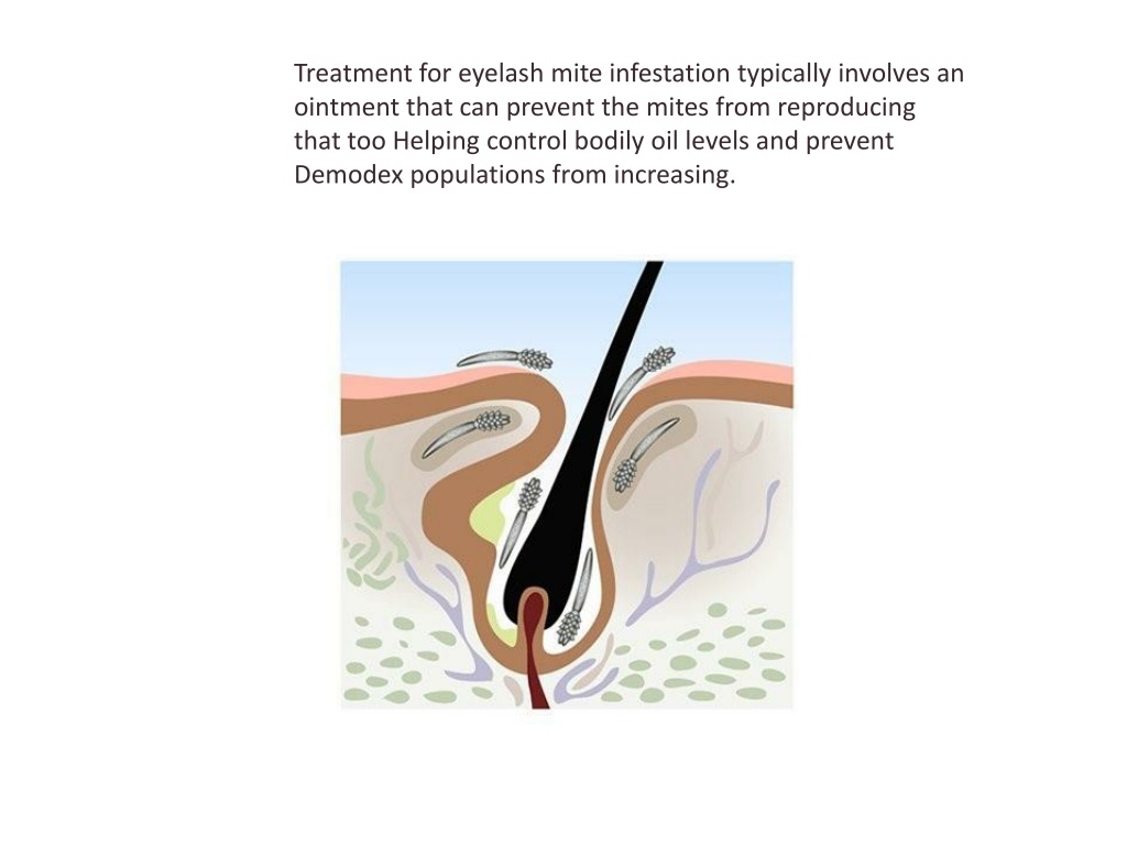 Ppt Eyelash Mites Treatment Powerpoint Presentation Free Download Id12057934 