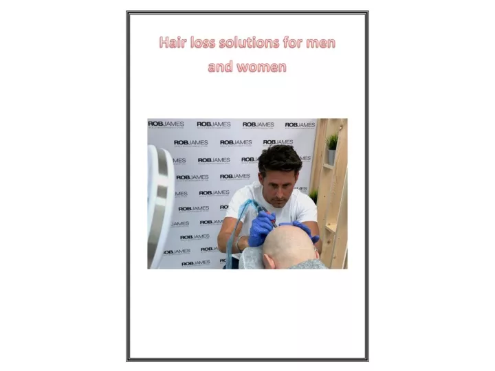 Ppt Hair Loss Solutions For Men And Women Powerpoint Presentation Free Download Id12064273