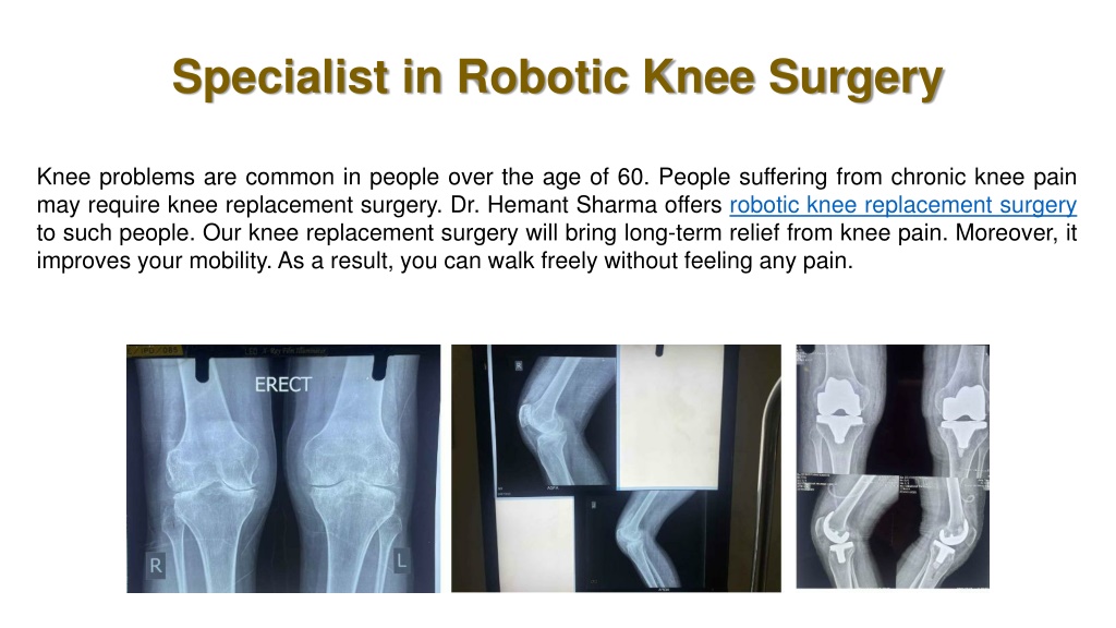 PPT Mako Robotic Knee Replacement Surgery PowerPoint Presentation Free Download ID 12064341