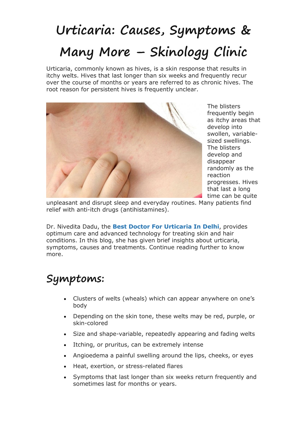 PPT - Urticaria Causes, Symptoms & Many More – Skinology Clinic ...