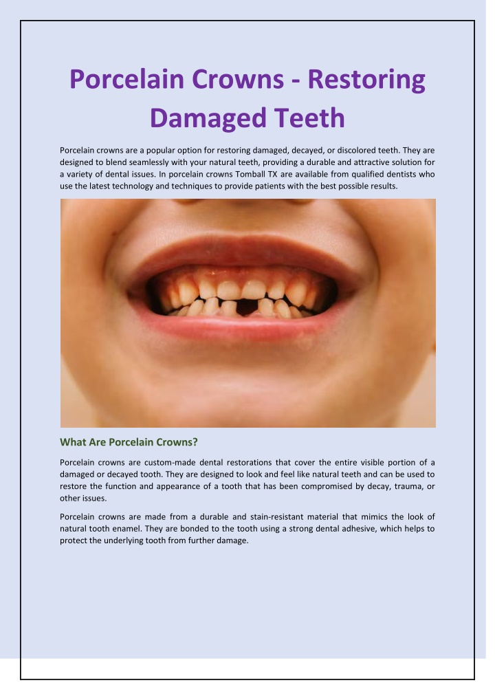 PPT Porcelain Crowns Restoring Damaged Teeth PowerPoint