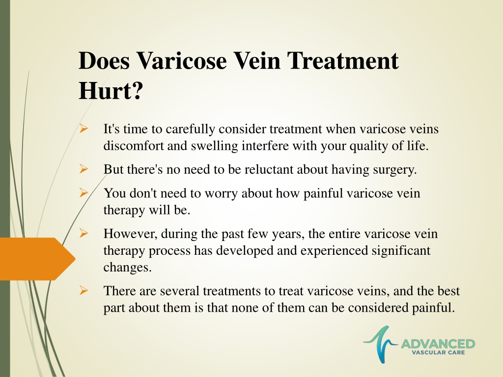 PPT - Varicose Vein Treatment - Will It Hurt? PowerPoint Presentation ...